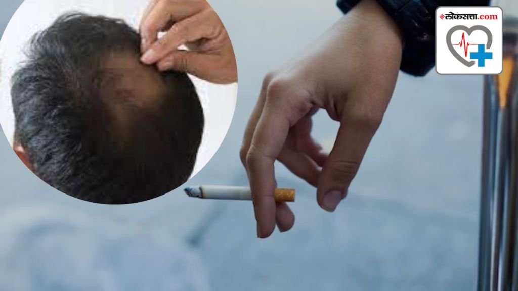 Smoking And Hair Loss