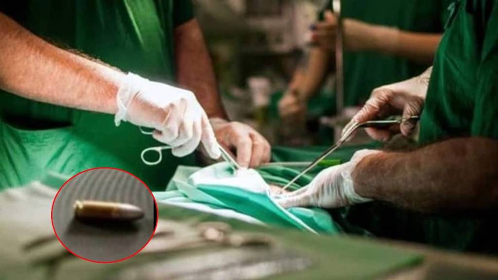 Doctors Remove Bullet stuck In पाो्