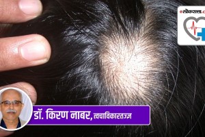 alopecia areata marathi news, alopecia areata disease marathi news, alopecia areata news in marathi