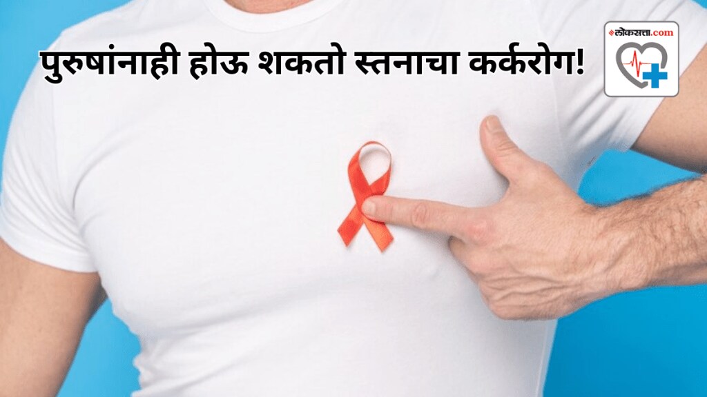 Awareness Causes Treatment of Breast Cancer in Male in Marathi