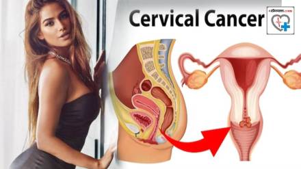 Poonam Pandey Death How To Prevent Cervical Cancer 10 Important Points To Stay Safe While Having Sex When Is Time To Take Vaccine