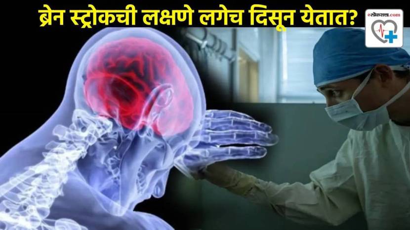 Sadhguru Brain Bleeding Causes Signs Of Symptoms Of Brain Tumor Look Out These Changes In Body Health Update On Jaggi Vasudev