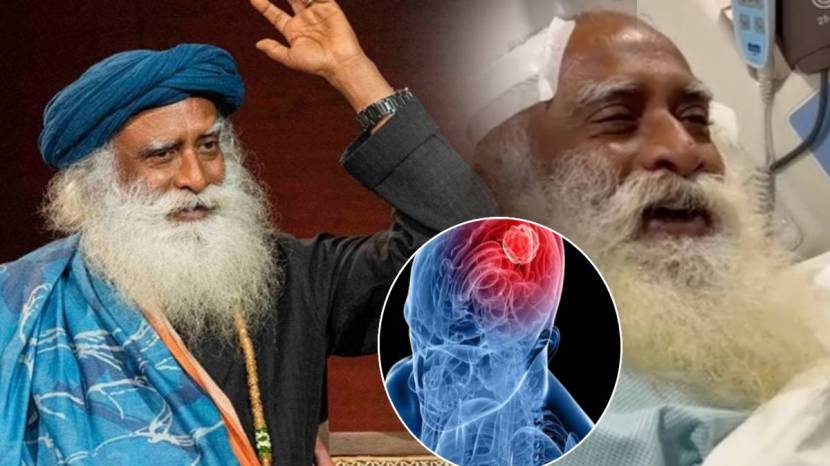 Sadhguru Brain Bleeding Causes Signs Of Symptoms Of Brain Tumor Look Out These Changes In Body Health Update On Jaggi Vasudev