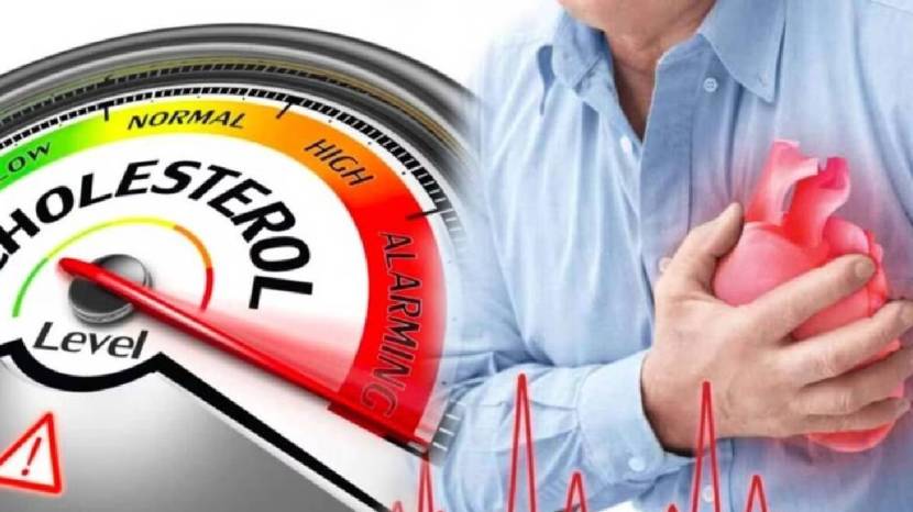 Bad Cholesterol Increased Shows Signs On Face Skin Nails Legs Does Yellow Stains Means Cholesterol or Jaundice Body Signs Health