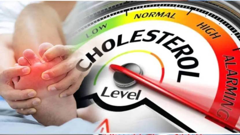 Bad Cholesterol Increased Shows Signs On Face Skin Nails Legs Does Yellow Stains Means Cholesterol or Jaundice Body Signs Health