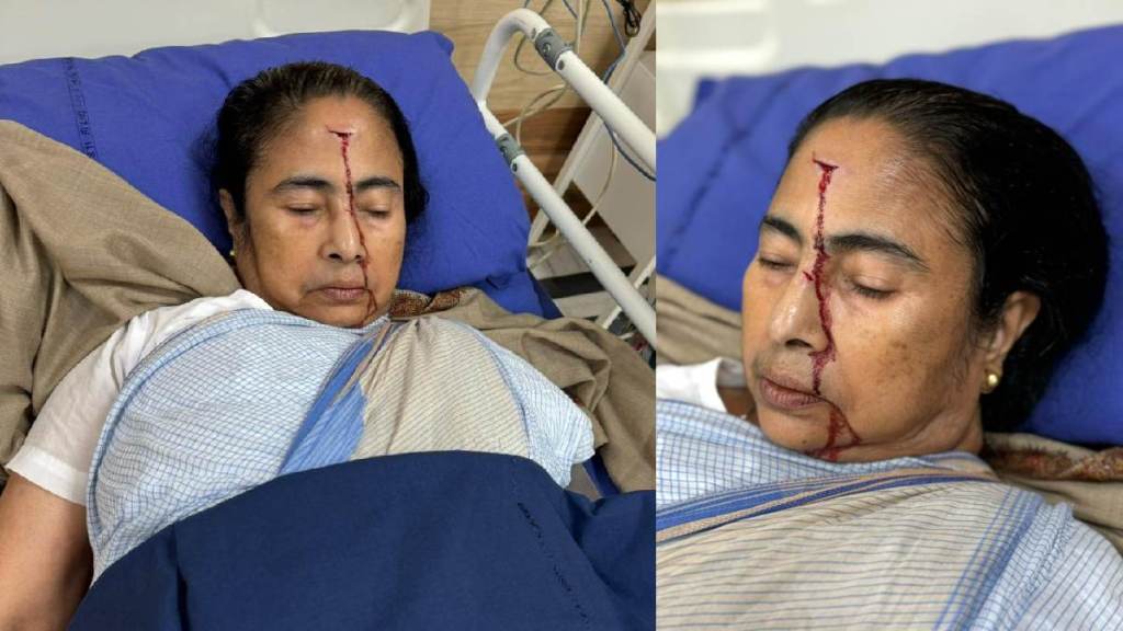 West Bengal CM Mamata Banerjee Head Injury Marathi News