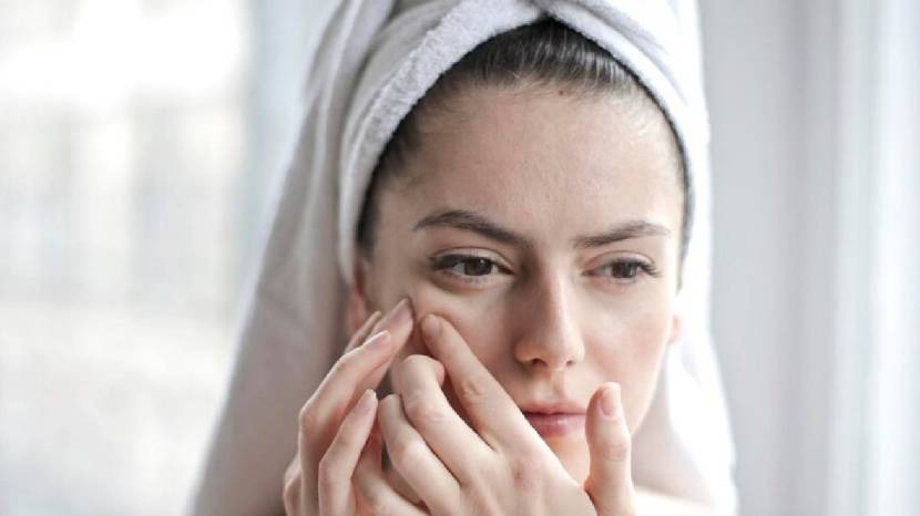 Try the following Simple And Useful remedies to stay away from acne problems in summer