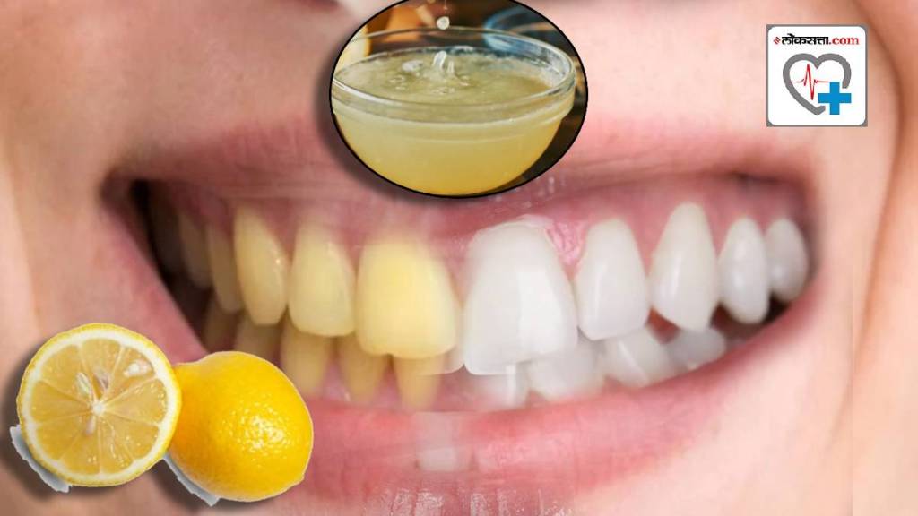 Lemon Baking Soda Hack To Change Yellow Stain Teeth White Hacks Explained By Doctor How lemon affect Teeth Gums Health Marathi