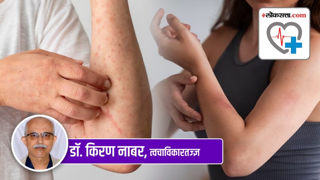 Health Special, allergies, start, avoid, skin, body, dust, health tips, health benefits,