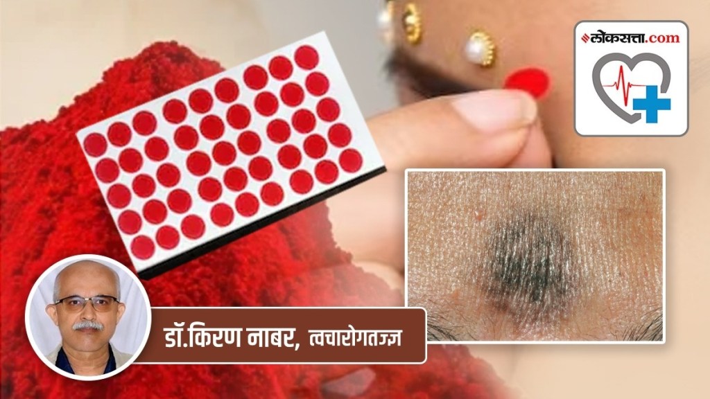 kumkum allergy marathi news, kumkum allergy treatment