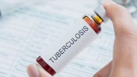 tuberculosis marathi news, tuberculosis genetic sequencing marathi news