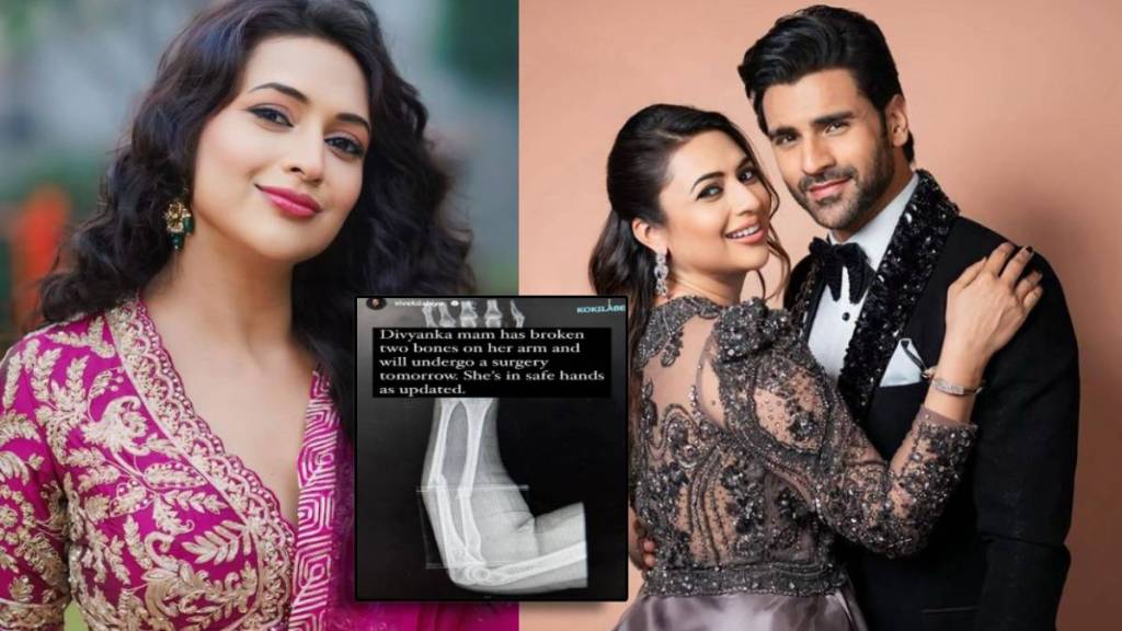 divyanka tripathi hand fractures undergo surgery