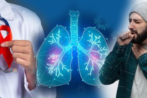 smokers and non addicts are also becoming victims of lung cancer