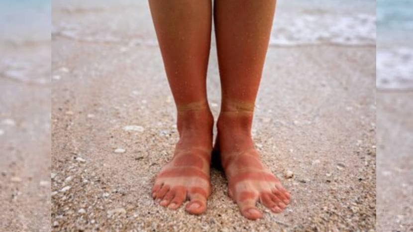 Home Remedies For Tanned Skin Of Hands And Legs