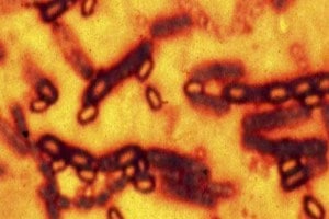 Spore forming bacterium