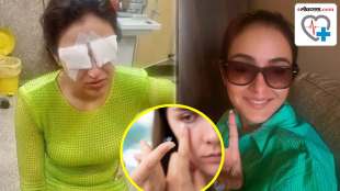 Jasmin Bhasin Diagnosed With Corneal Damage know causes symptoms healing time and treatment of this eye infection