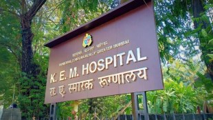 heart transplant surgery at kem hospital