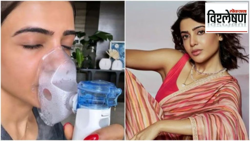 samantha ruth prabhu hydrogen peroxide nebulisation