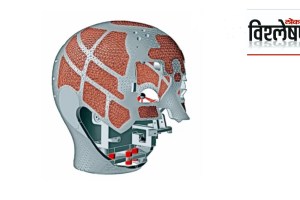 Final skull design with lattice structures. Journal of Institution of Engineers, India