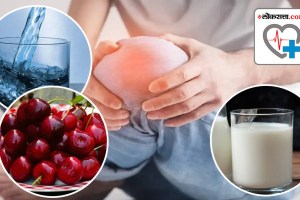 Food to Reduce Uric Acid