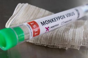 Despite more students from Africa states health department is awaiting the Centres nod about Monkeypox