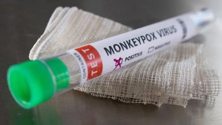 Despite more students from Africa states health department is awaiting the Centres nod about Monkeypox