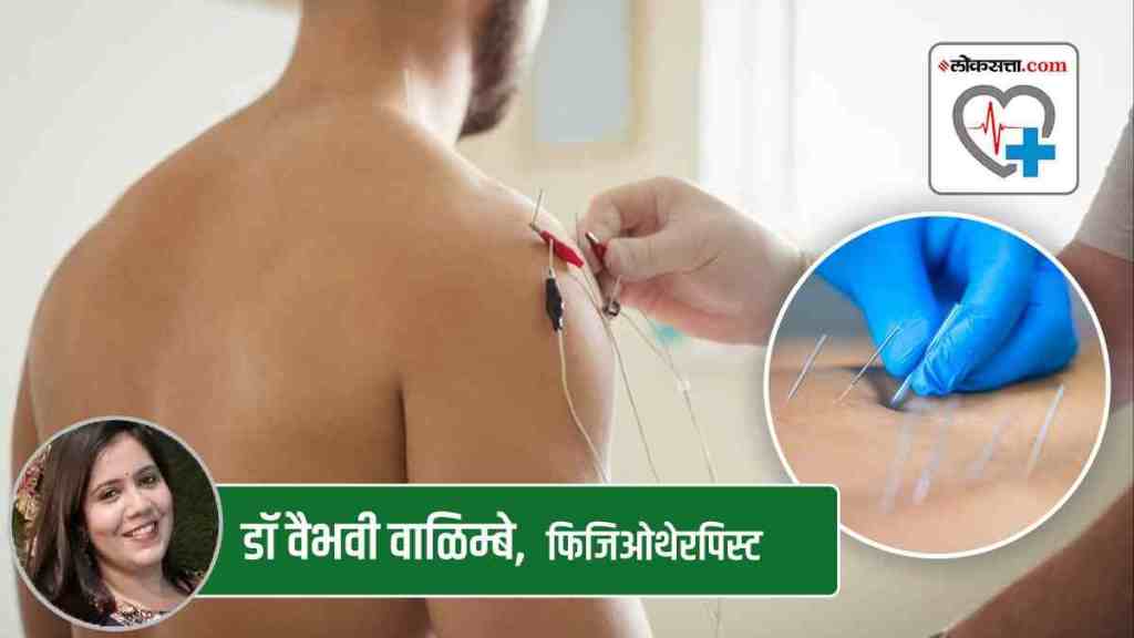 pain relief, dry needling, physiotherapy, exercise, lifestyle changes, neck pain, chronic pain, pain management, posture improvement, patient education,