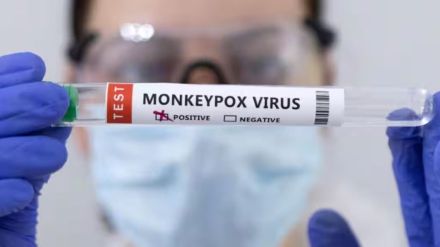 vaccine on monkeypox will be in year