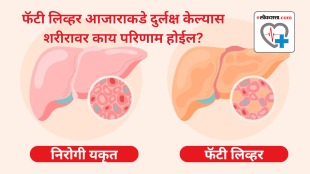 Find out what happens to the body when you ignore fatty liver disease