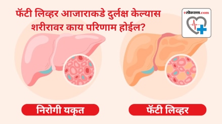 Find out what happens to the body when you ignore fatty liver disease