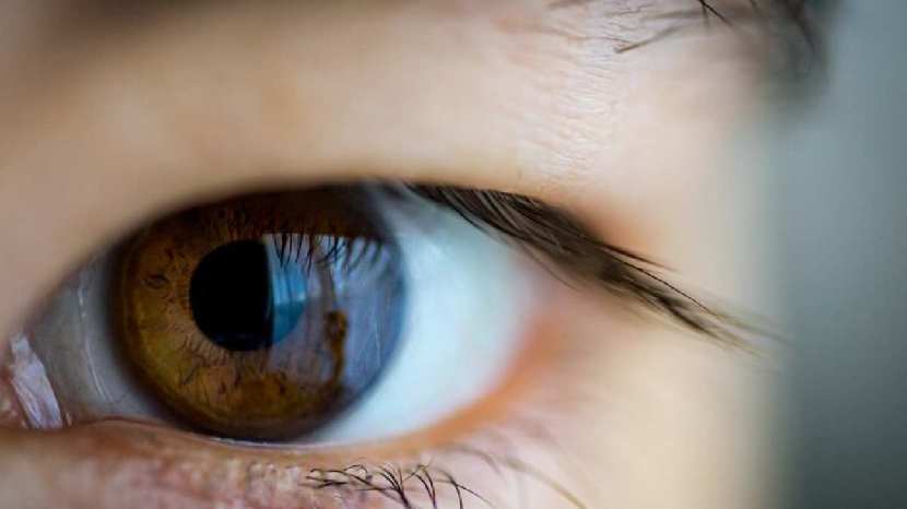 Cataracts are also risk for young people