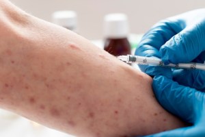 Second Mpox case reported in Kerala as man who returned from the UAE tests positive google trends