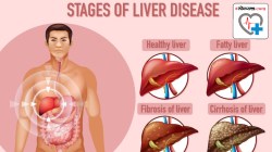 Liver health: दहा पैकी तीन लोकांमध्ये यकृताची समस्या; कशी काळजी घ्याल स्वत:ची? जाणून घ्या