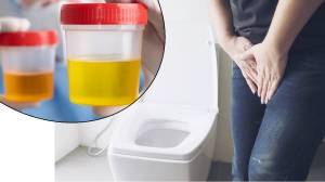 Painful Urination : लघवी करताना जळजळ, वेदना जाणवतेय? ही असू शकतात ‘या’ ४ आजारांची लक्षणे, असे करा उपचार