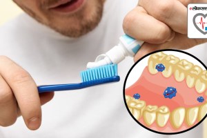 Find out what happens to the body when you don’t brush teeth for a month side effects of not brushing your teeth for a month