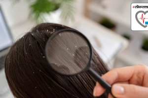 season do hair lice occur