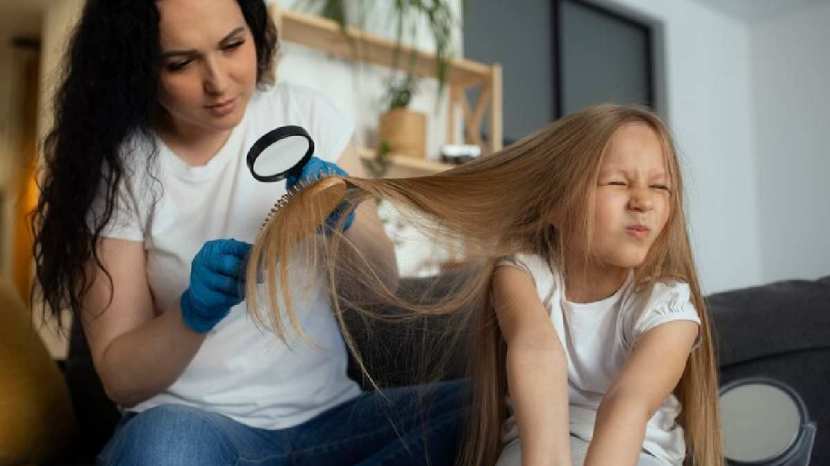 Expert tips to get rid of head lice