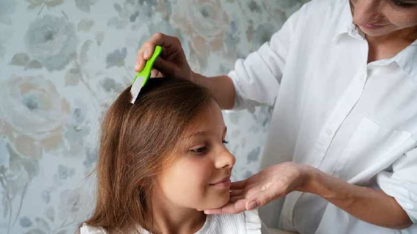 Expert tips to get rid of head lice