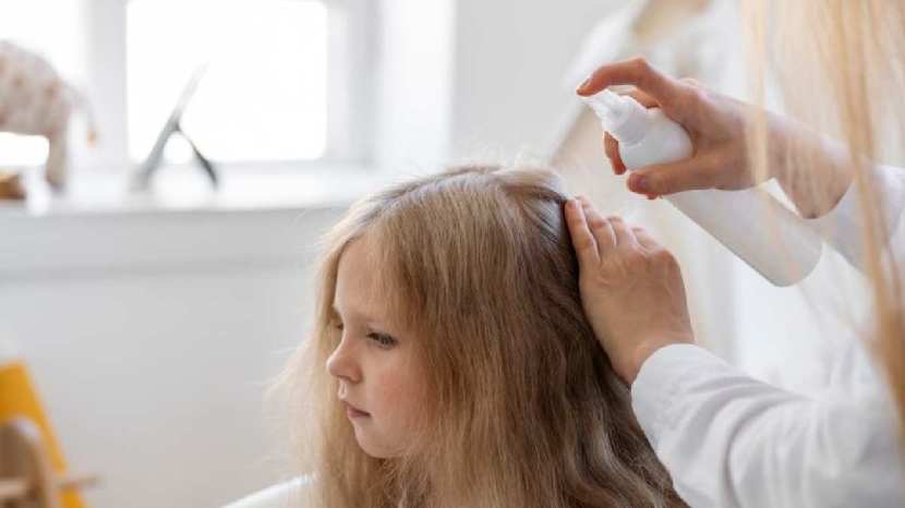 Expert tips to get rid of head lice