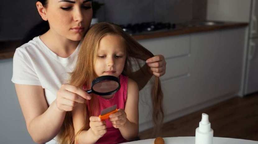 Expert tips to get rid of head lice