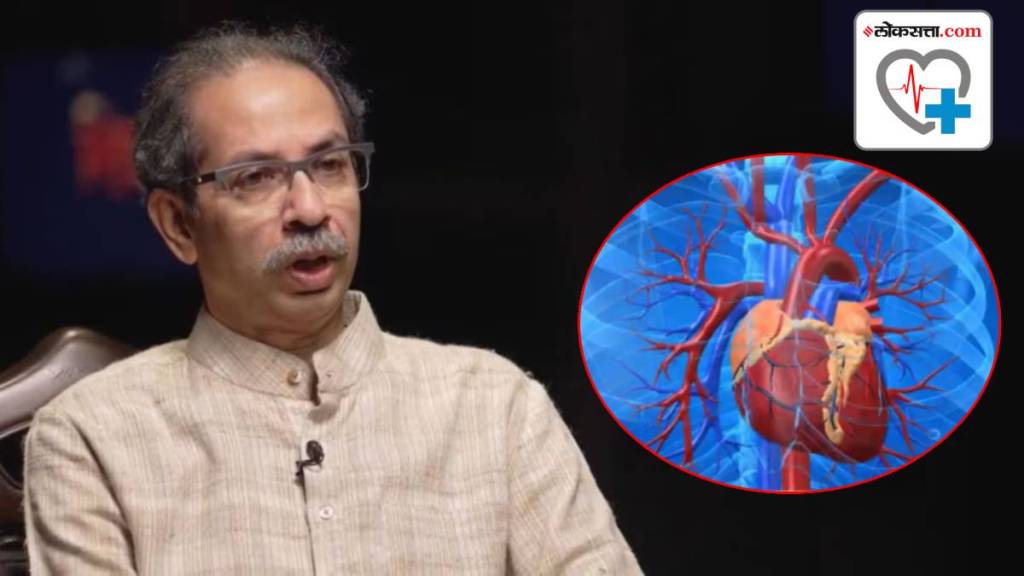 Uddhav Thackeray angioplasty, Uddhav Thackeray Undergo Angioplasty In Mumbai