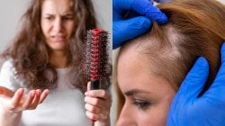 Hair Loss: केसांचे आरोग्य सुधारण्यासाठी आजपासूनच टाळा ‘या’ पदार्थांचे सेवन, केस गळतीही होईल कमी