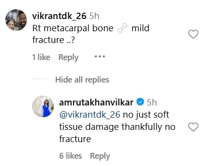 Amruta Khanvilkar Suffers Hand Injury