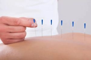 12 colleges in state offering acupuncture treatment for first time