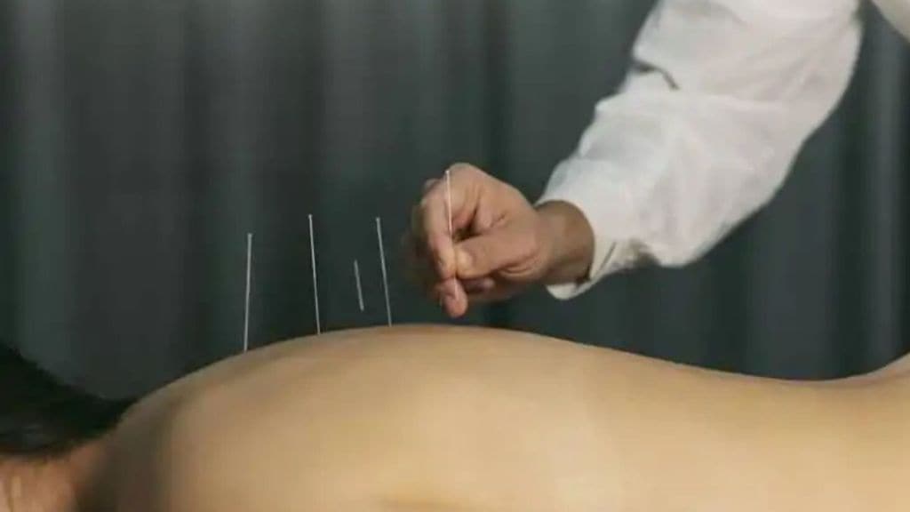 admission process for acupuncture course till December 20