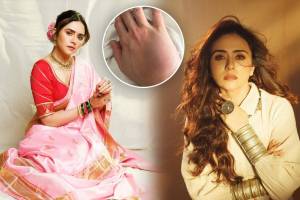 amruta khanvilkar hand injury