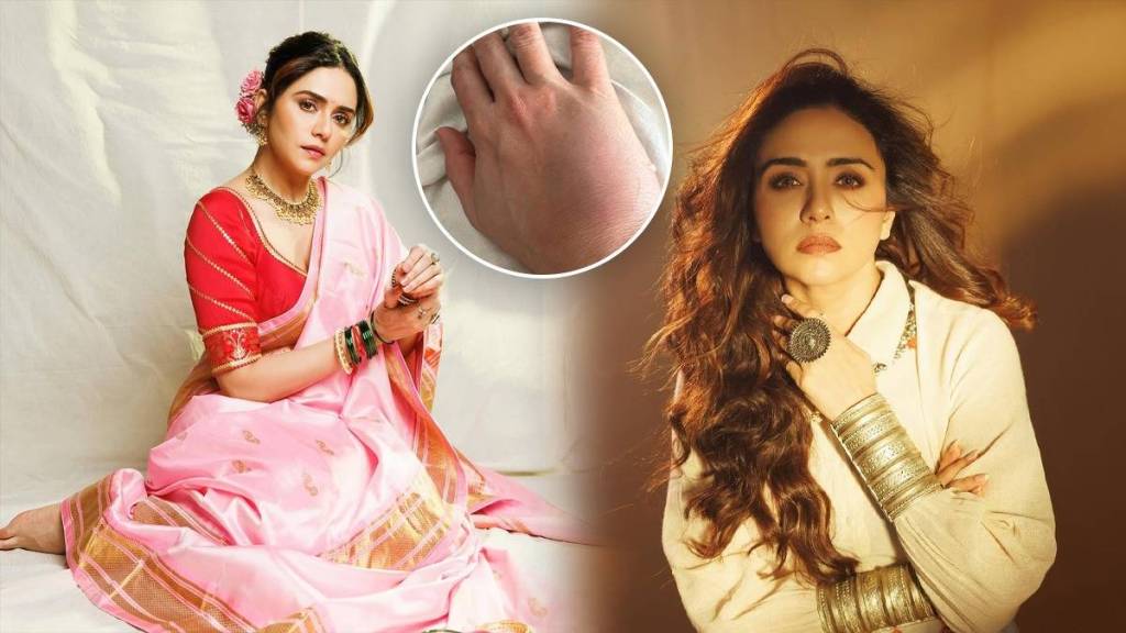 amruta khanvilkar hand injury