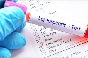 Leptospirosis deaths