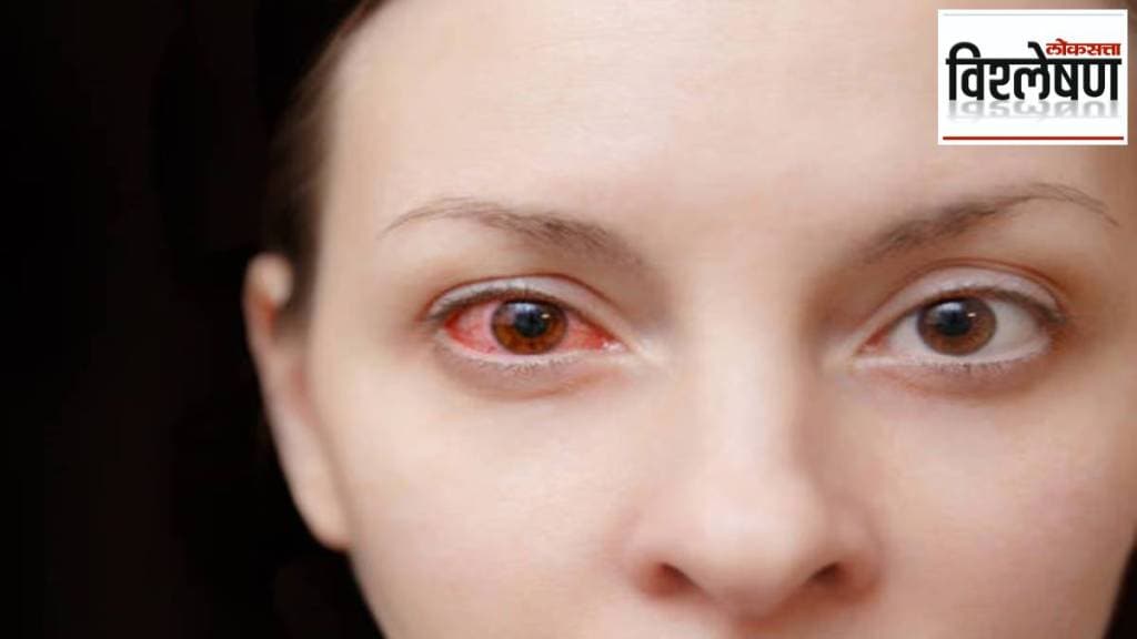 about symptoms treatment vaccine for Bleeding eye disease