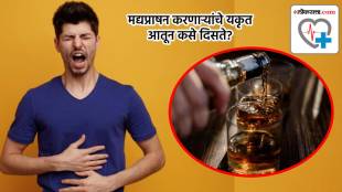 liver damage causes | alcohol drinking mans liver health news marathi